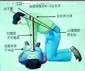 2015年國際新標準心肺復蘇術操作指南,流程 2015年國際新標準心肺復蘇術操作指南,流程